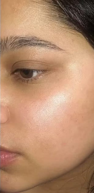 After