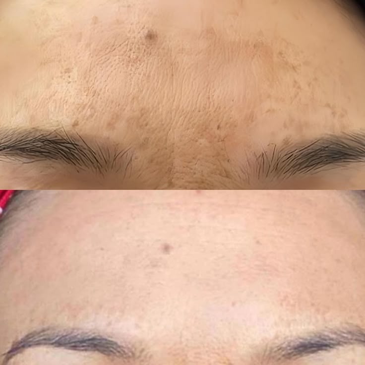 Kojic Acid Brightening Soap