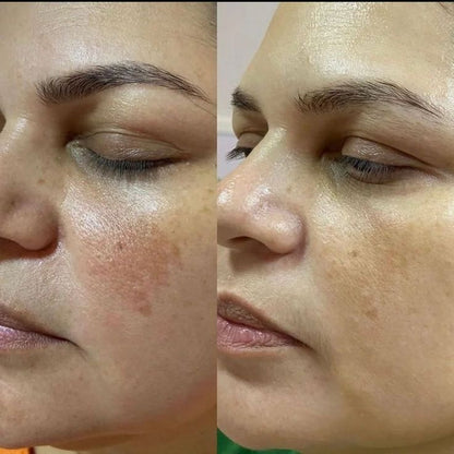 Kojic Acid Brightening Soap